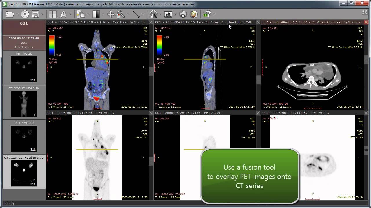 download radiant dicom viewer for mac